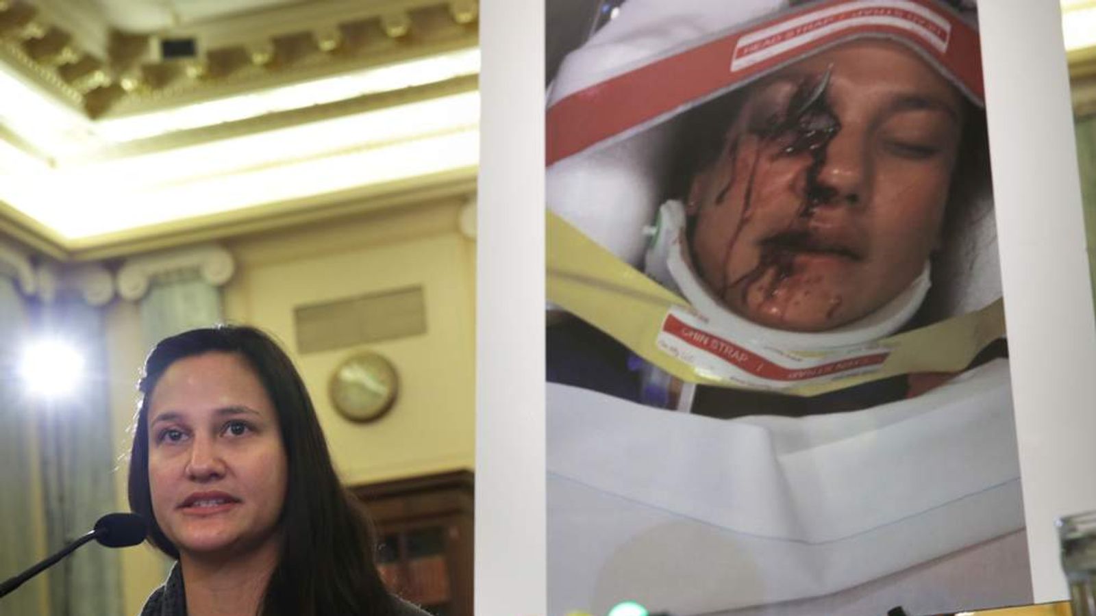 Stephanie Erdman, of Destin, Florida, testifies about her airbag injuries