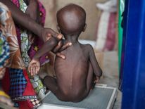 A malnourished child at the Muna settlement, which houses nearly 16,000 refugees on the outskirts of Maiduguri