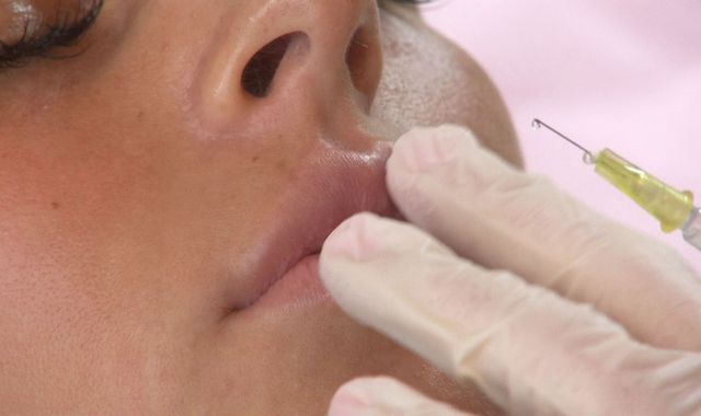 Victim of botched lip filler op warns of dangers Victim of botched lip filler op warns of dangers