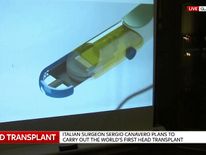 The knife to be used by Prof Sergio Canavero in what he hopes will be the first human head transplant