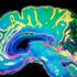 Moody? Neurotic? Blame your brain shape