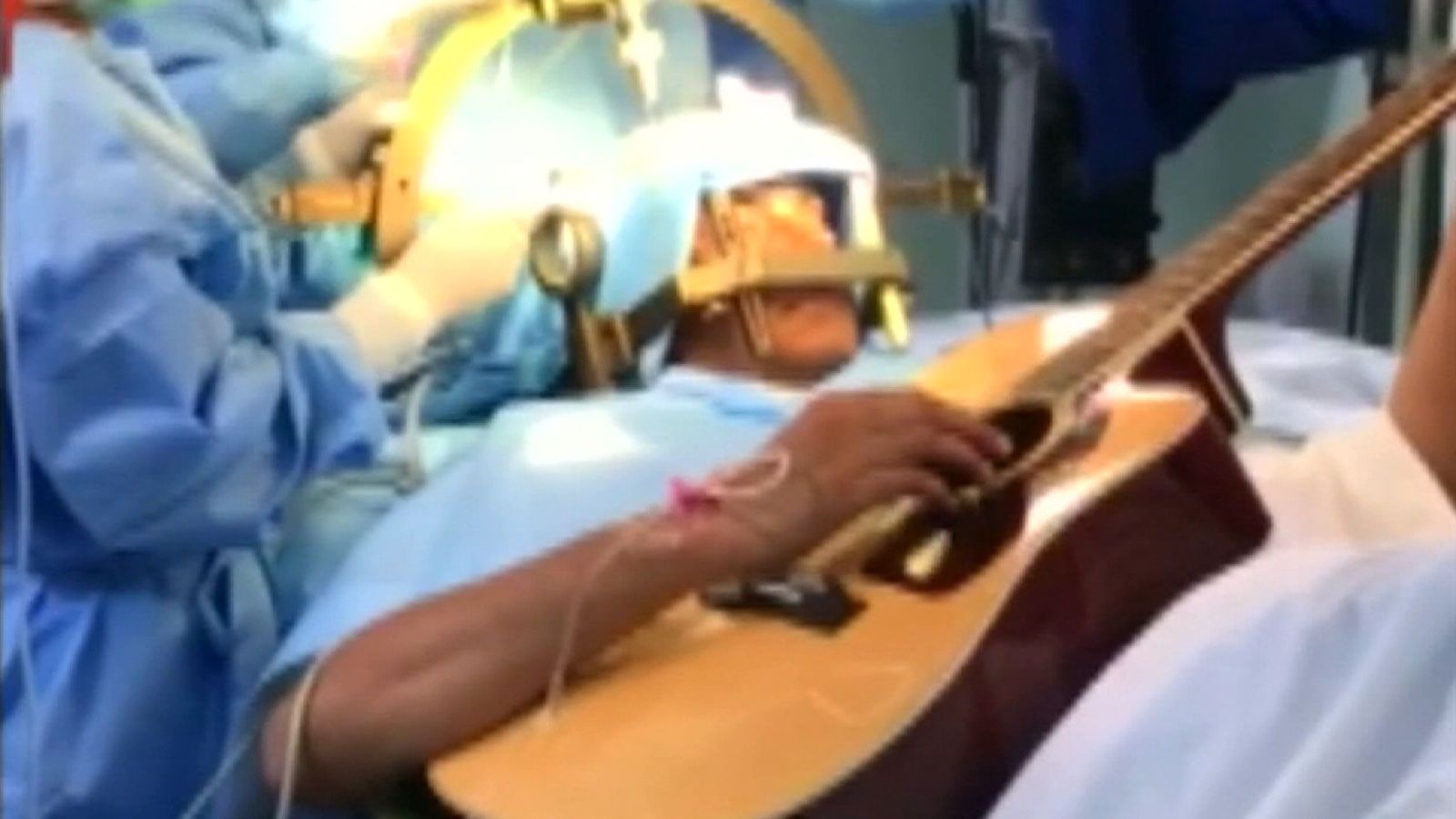 Bengaluru man treats himself by playing guitar during brain surgery