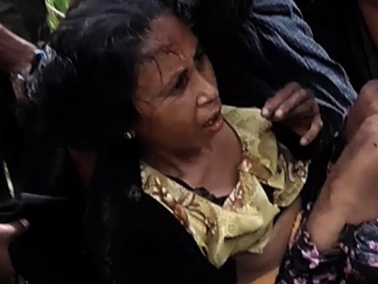 Sky News was told this woman had her legs blown off by a landmine