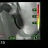 Bodycam
