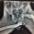 X-Ray showing the injuries after someone had their feet up on the dashboard during a crash. Pic: Dyfed-Powys Police