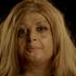 Tusli Vagjiani is supporting a campaign by the Changing Faces charity