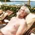 Most skin cancer cases are due to excessive exposure to the sun