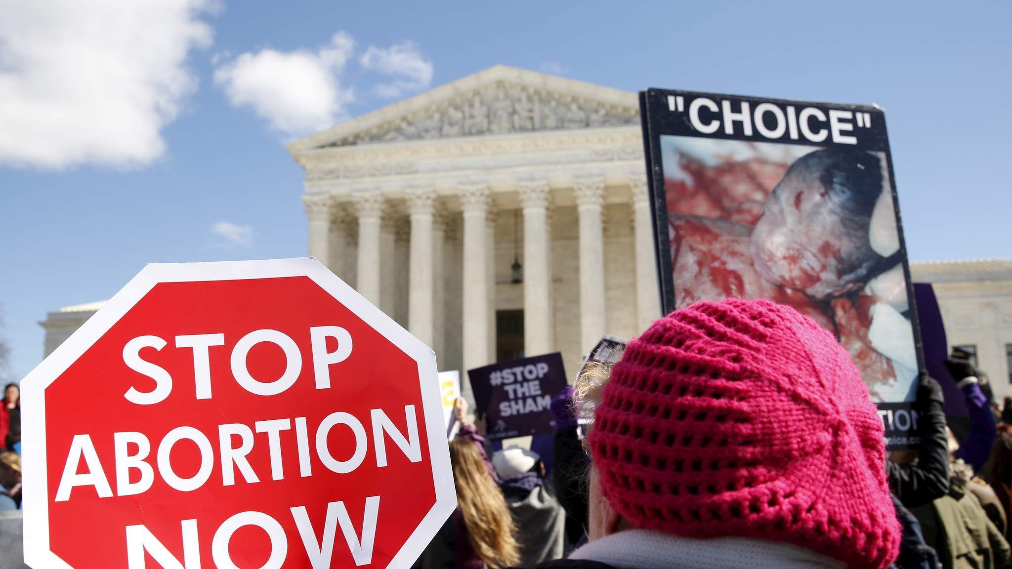 Texas Abortion Case Divides Supreme Court US News Sky News