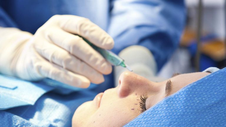 A woman having cosmetic surgery around her eyes