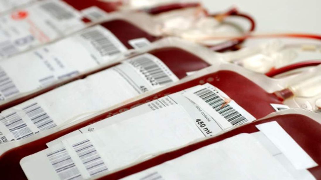 Blood Transfusions 'Could Spark CJD Deaths'