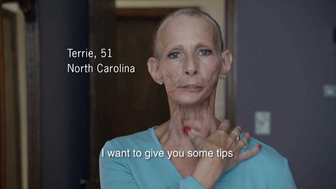Woman In Shock Anti Smoking Ad Dies Of Cancer