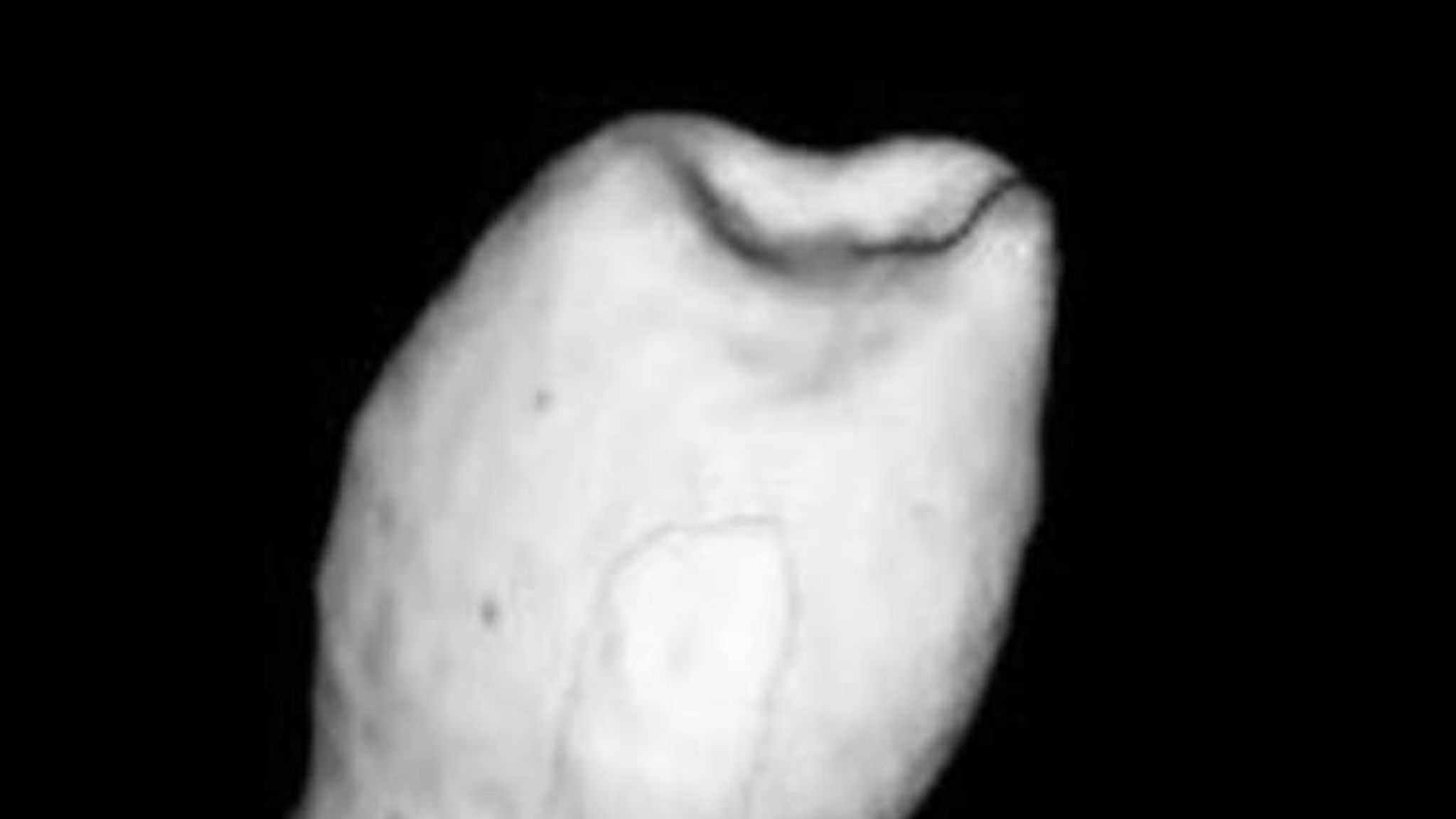 Tooth Grown From Human And Mouse Cells UK News Sky News