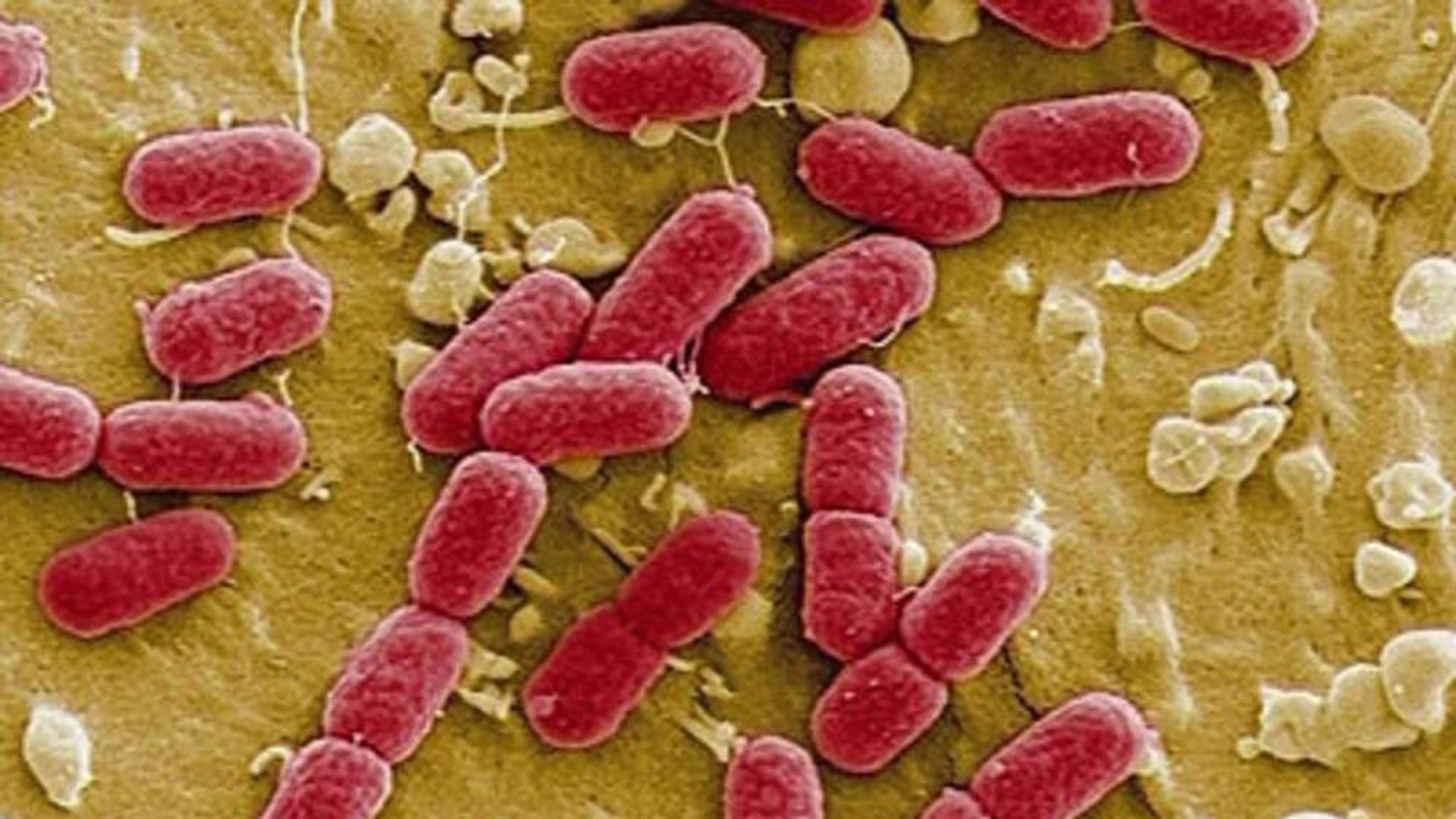 E.coli Outbreak Q&A How To Stay Safe UK News Sky News