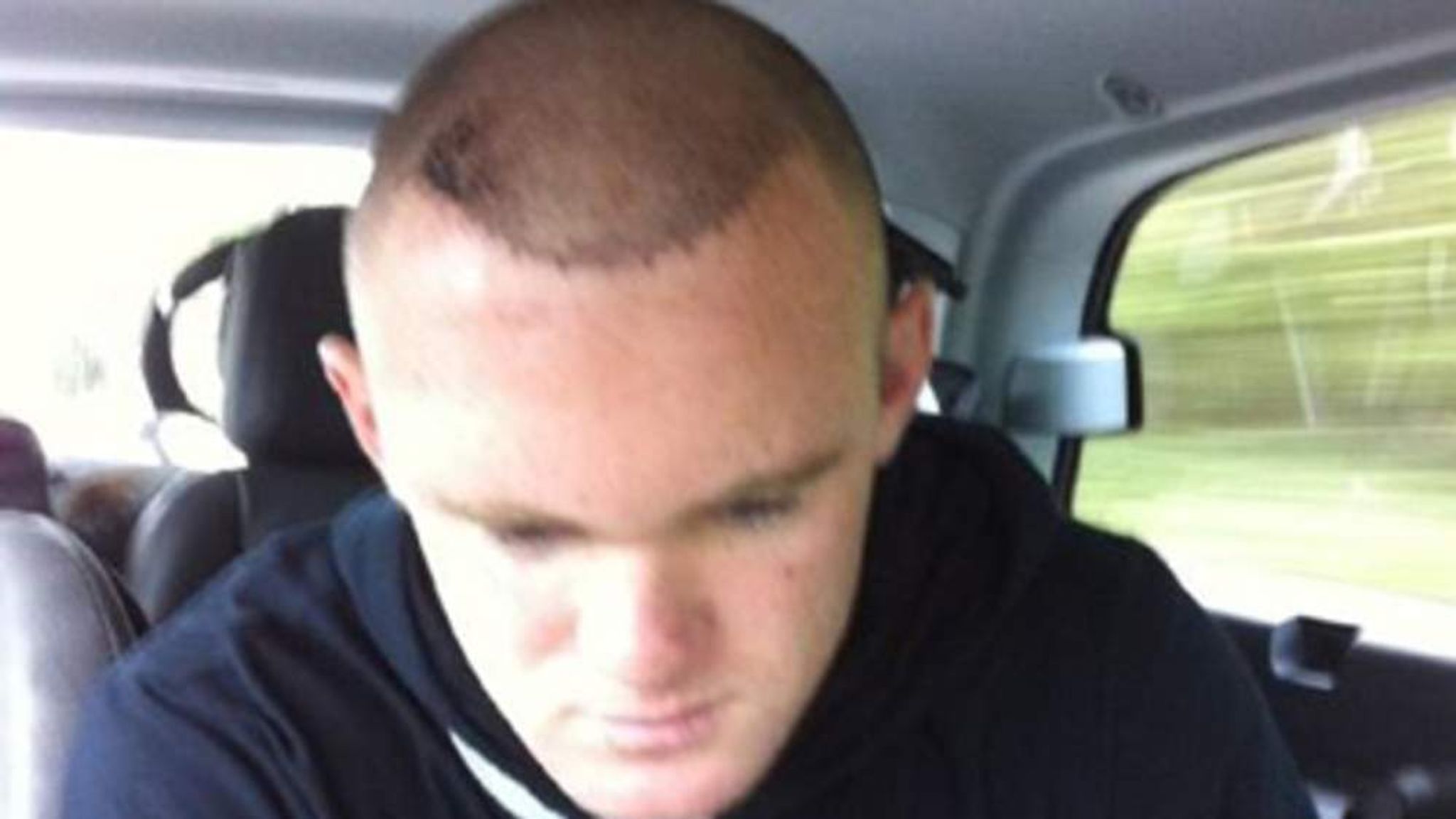Rooney Shows Off His New Barnet After Hair Transplant | Scoop News | Sky  News