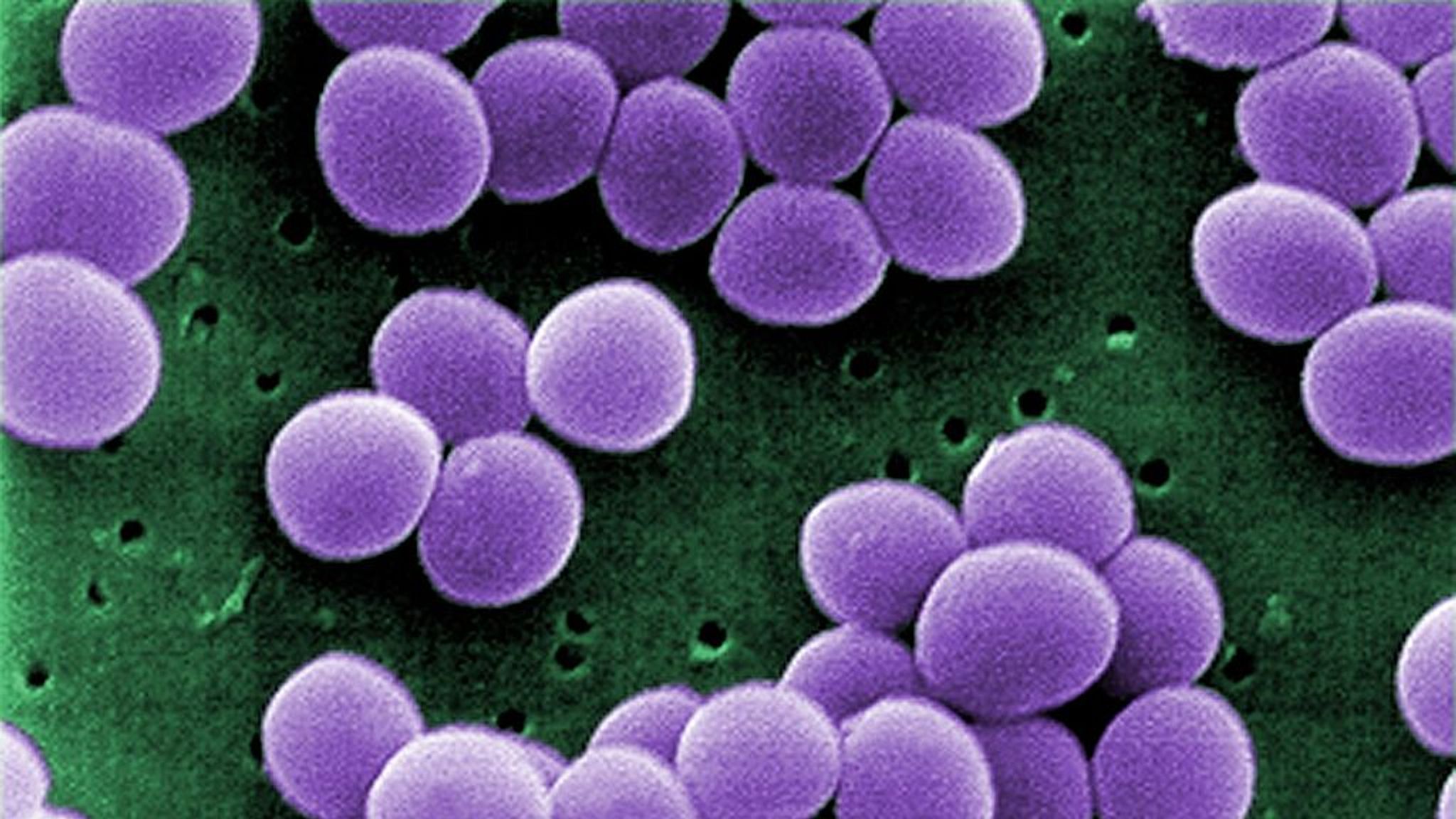 Staphylococcus aureus 4. Сапрофитный стафилококк. Эпидермальный стафилококк. Стафилококки генцианвиолет.