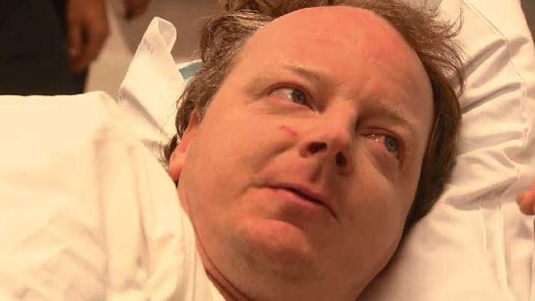 Shark Attack Victim Drives Himself To Hospital World News Sky News