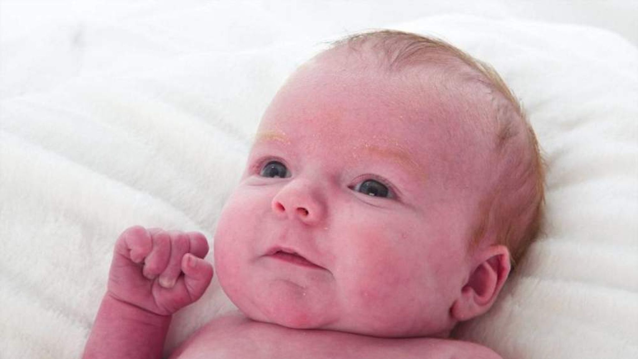 Почему новорожденный стал. Мраморность кожных покровов у новорожденных. Мраморность у грудничка. Мраморная кожа у младенца. Мраморная кожа у грудничка.