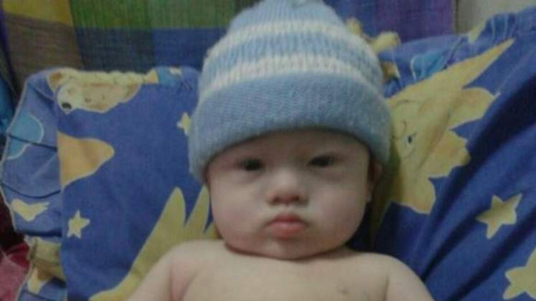Малыш с синдромом Дауна 7 месяцев