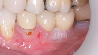 Beauticians Who Whiten Teeth Damage Oral Health