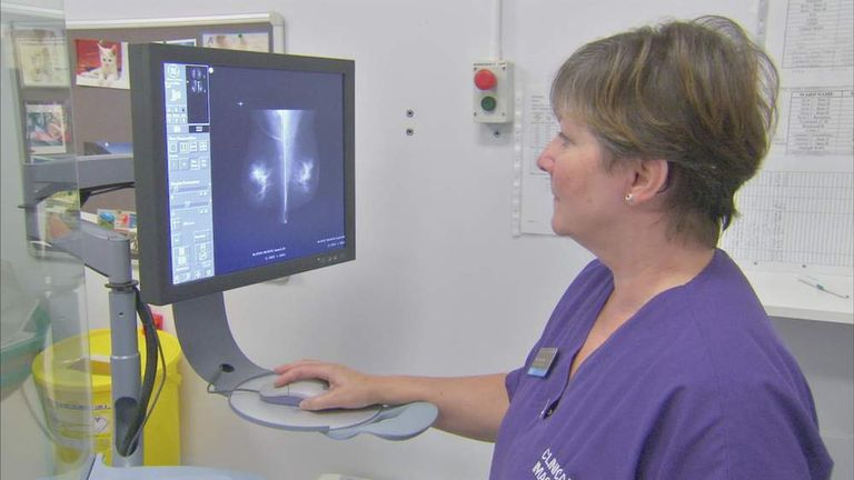 Mammogram screening procedure for breast cancer