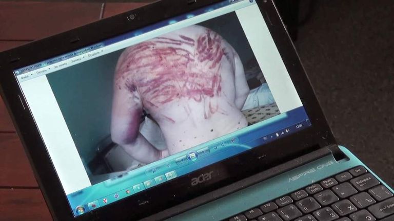 Amnesty International release video of alleged torture victims