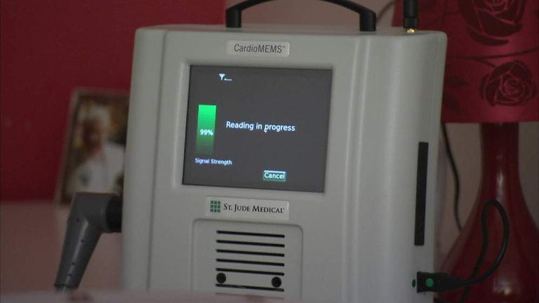 heart monitor implants heart monitor implants
