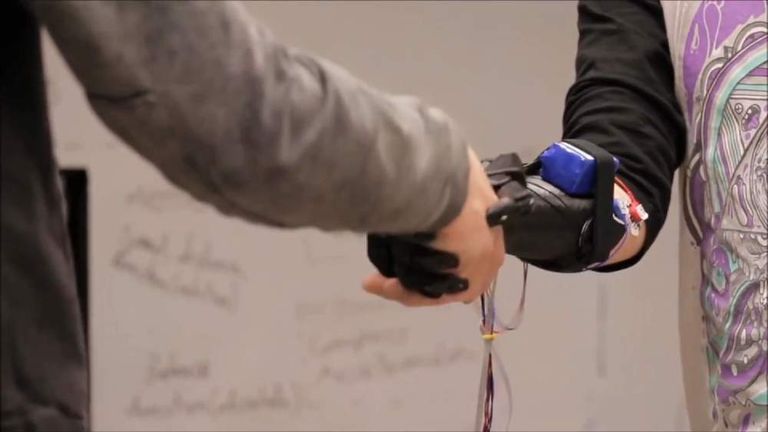 3D Printing Offers Hope To Amputees By Making Prosthetics Cheaper