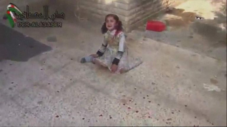 A little girl hurt in alleged cluster bomb attack in Syria
