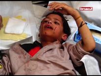 Twenty eight children are being treated in hospital following the airstrike, says MSF