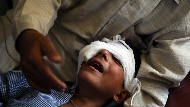 A father claims his son was injured by pellets shot by security forces in Srinagar, Kashmir
