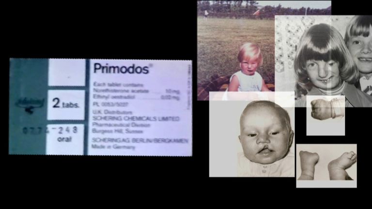 A public inquiry in investigating allegations of birth defects as a result of the drug Primodos