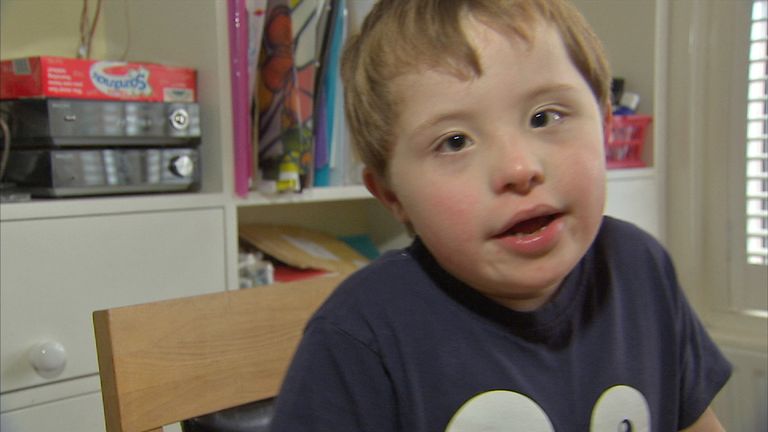 Campaigners urge caution over a new test for down&#39;s syndrome