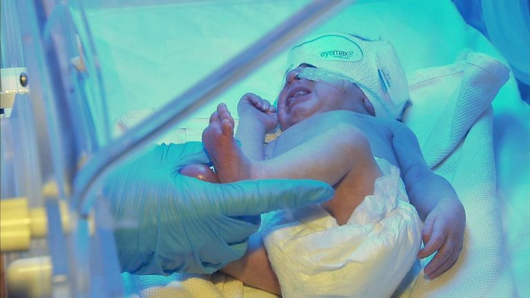 Image of newborn baby being treated in hospital.
