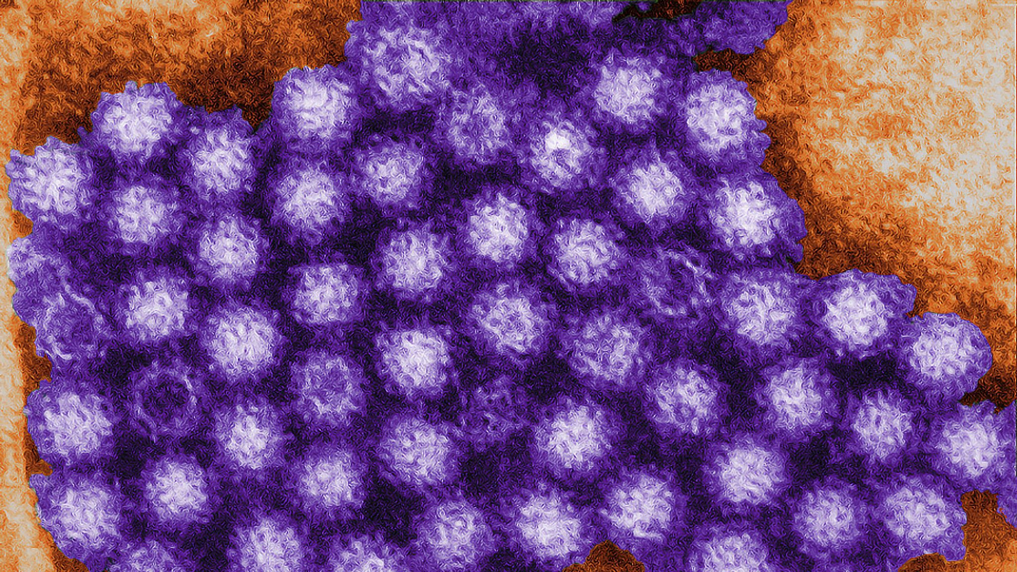 Norovirus levels 'highest in over a decade' for this time of year UK
