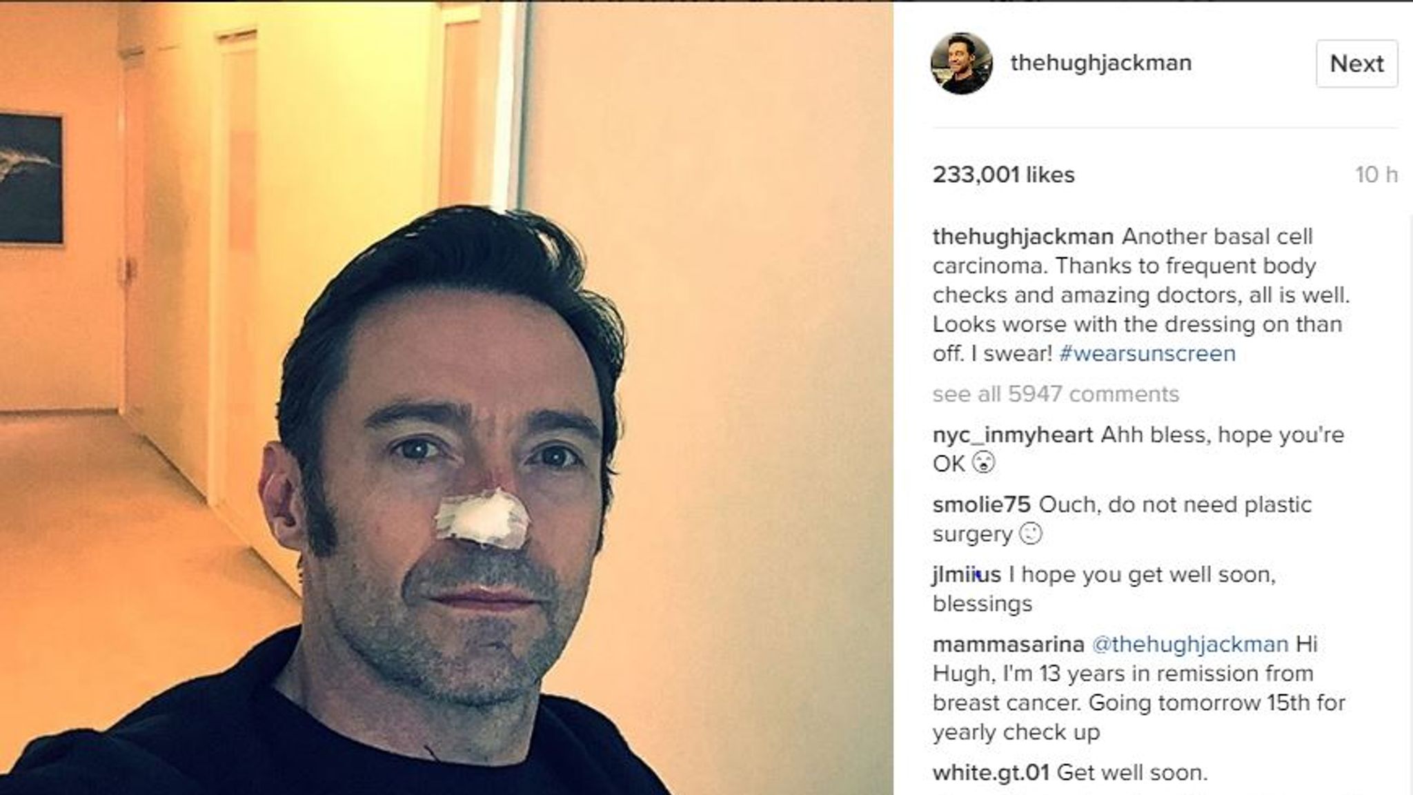 Actor Hugh Jackman has sixth skin cancer removed from his nose | Ents & Arts News | Sky News