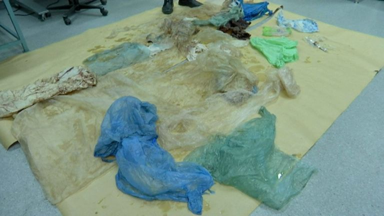 The whale&#39;s intestines were clogged with plastic, preventing it from feeding