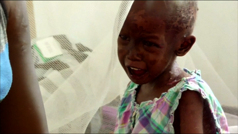 South Sudan: 270,000 children are at risk of starvation, according to UNICEF. 