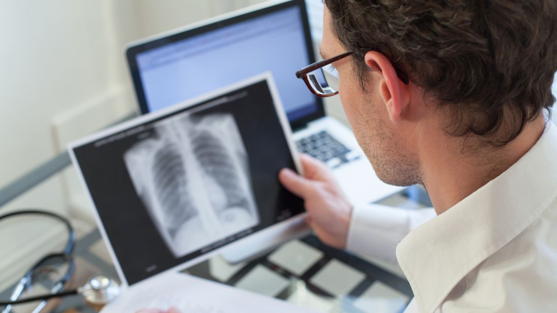 A doctor looks at an x-ray of a chest. File pic