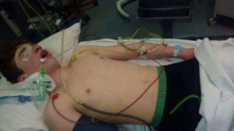 Ben's aunt put a photo of him in a coma from ecstasy earlier this year