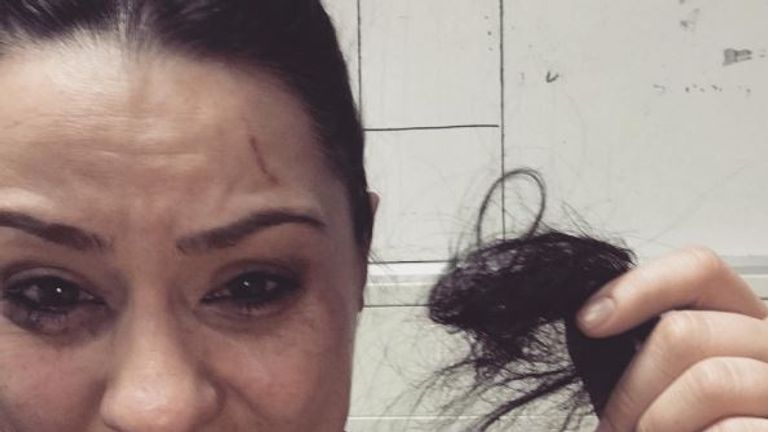Two women have been arrested over the attack. Pic: Lucy Spraggan/Instagram