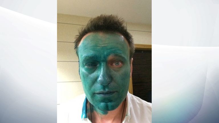 Alexei Navalny after the attack