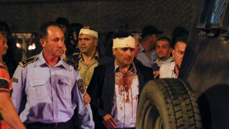 Macedonian police escort injured members of parliament including Social Democratic leader Zoran Zaev