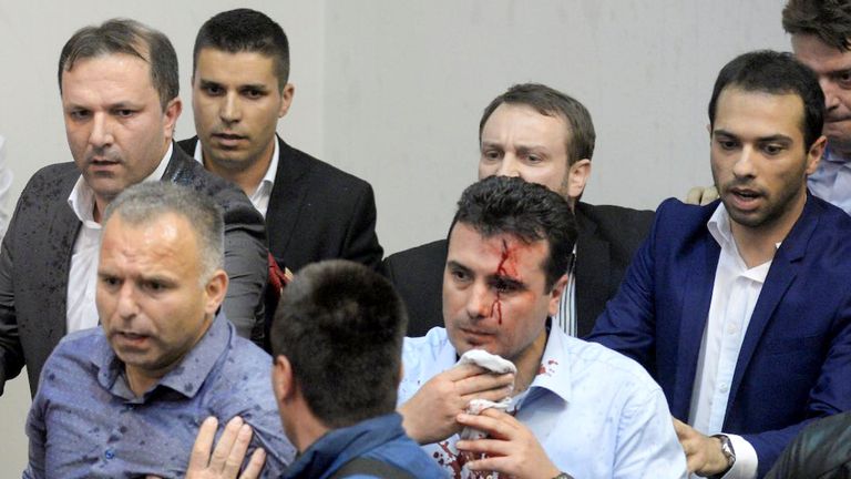 An injured leader of the Social Democrats Zoran Zaev is escorted out of the parliament in Skopje
