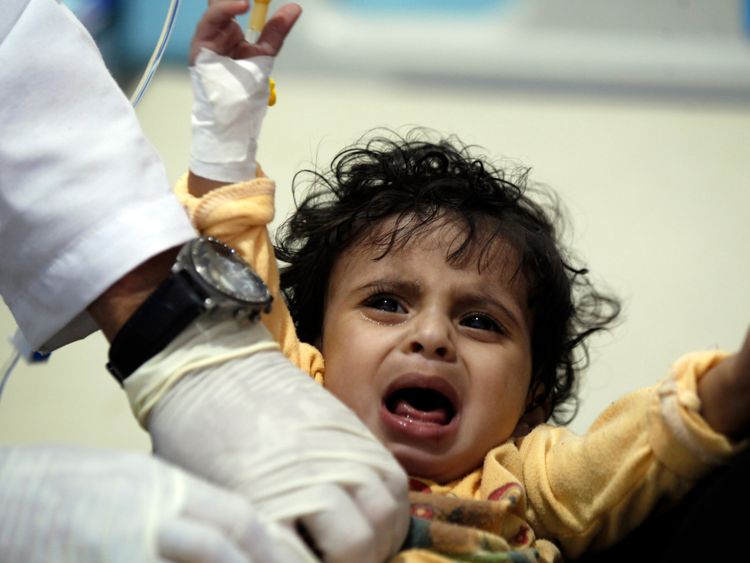 A Yemeni child receives treatment for suspected cholera at a hospital in Sanaa