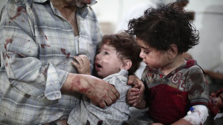 Injured Syrian children react as they are treated at a makeshift hospital on June 28, 2014, following a reported car bomb explosion at a popular market in the rebel-held town of Douma