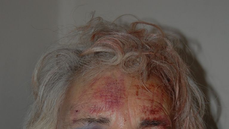Catherine Smith was assaulted by a woman who pushed through her front door