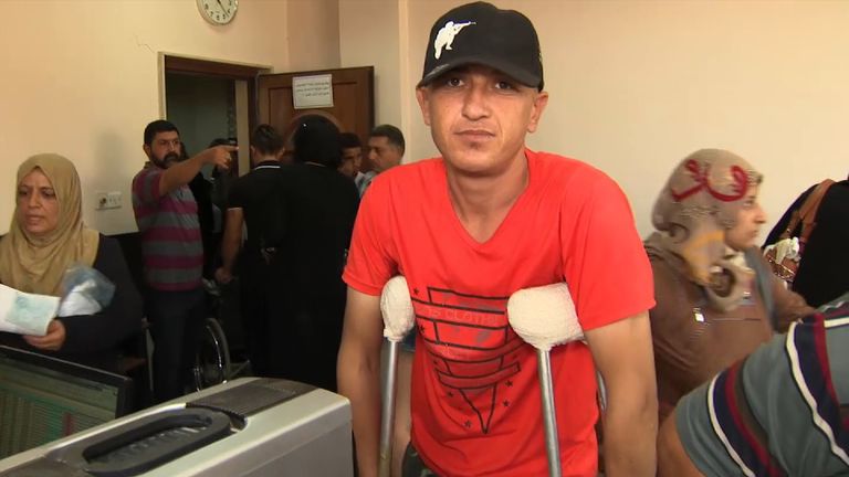 A man on crutches waits in line for treatment