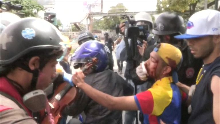 Venezuela violinist being helped by paramedics after march