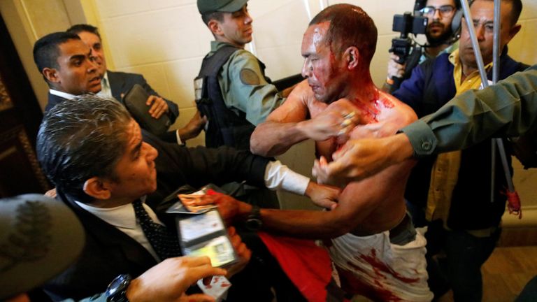 An injured government supporter tries to leave the building after he and a group of fellow government supporters burst into Venezuela's opposition-controlled National Assembly 