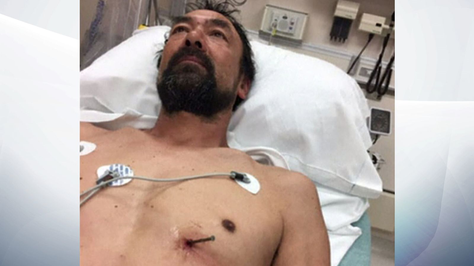 Man 'lucky to survive' after shooting himself in heart with nail gun
